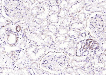 CD239 Recombinant Rabbit Monoclonal Antibody