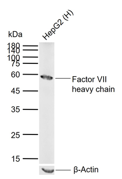 Factor VII heavy chain Rabbit Polyclonal Antibody