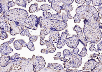 Vitamin D Binding protein Mouse Monoclonal Antibody