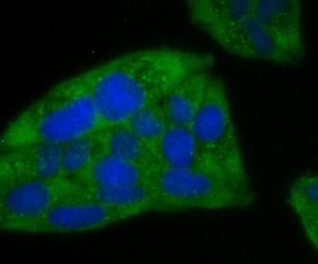 Ferritin Heavy Chain Recombinant Rabbit Monoclonal Antibody