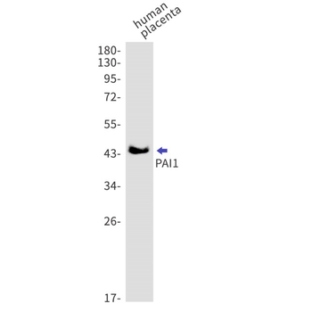 PAI1 Recombinant Rabbit Monoclonal Antibody
