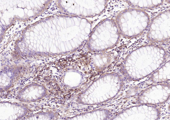CD206 Recombinant Rabbit Monoclonal Antibody
