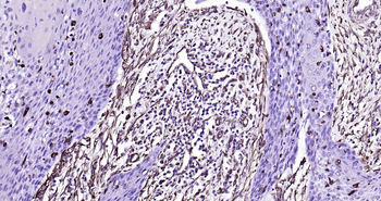 Human Vimentin Ready-To-Use IHC Kit