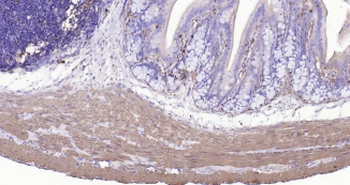 Rat alpha smooth muscle Actin Ready-To-Use IHC Kit