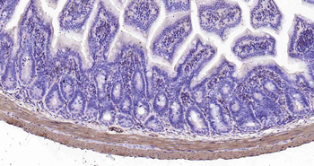 Mouse alpha smooth muscle Actin Ready-To-Use IHC Kit
