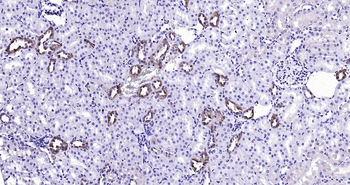 Rat Calbindin Ready-To-Use IHC Kit