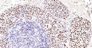 Human MYBL2 Ready-To-Use IHC Kit