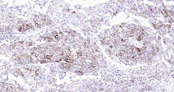 Human Cytokeratin 7 Ready-To-Use IHC Kit