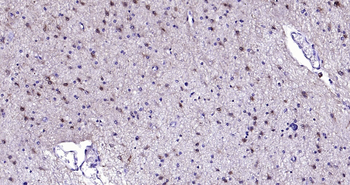 Human S100B Ready-To-Use IHC Kit