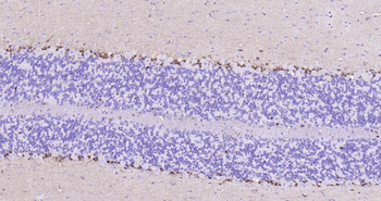 Mouse S100B Ready-To-Use IHC Kit