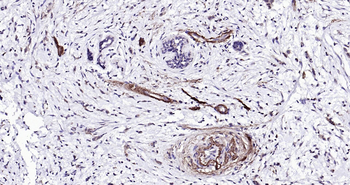 Human Peripherin Ready-To-Use IHC Kit