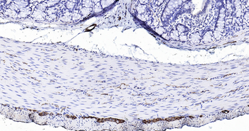 Rat Peripherin Ready-To-Use IHC Kit