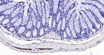 Mouse Peripherin Ready-To-Use IHC Kit