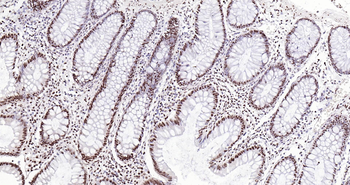 MYBL2 Ready-To-Use IHC Kit