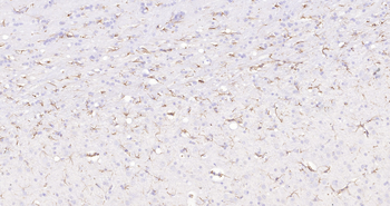 Rat GFAP Ready-To-Use IHC Kit