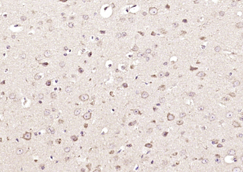 USP9X Rabbit Polyclonal Antibody