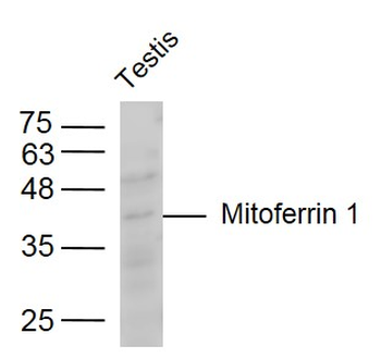 Mitoferrin 1 Rabbit Polyclonal Antibody