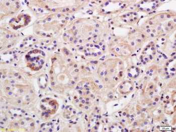 TRIM41 Rabbit Polyclonal Antibody