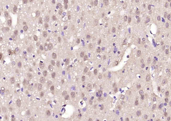 ZNF354C Rabbit Polyclonal Antibody
