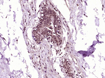 RanBP1 Rabbit Polyclonal Antibody