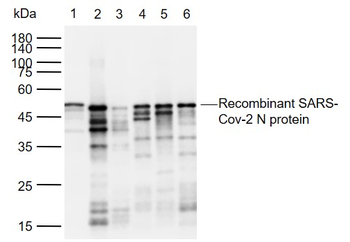 SARS-CoV-2 (2019-nCoV) Nucleocapsid Mouse Monoclonal Antibody
