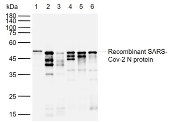 Anti-SARS-CoV-2 (2019-nCoV) Nucleocapsid