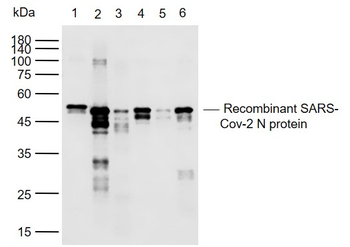SARS-CoV-2 (2019-nCoV) Nucleocapsid Mouse Monoclonal Antibody