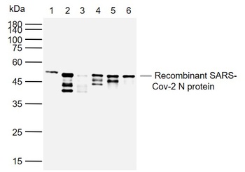 Anti-SARS-CoV-2 (2019-nCoV) Nucleocapsid