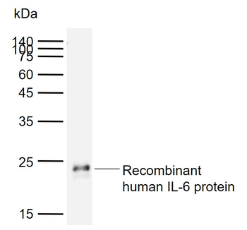 IL-6 Mouse Monoclonal Antibody