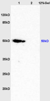Caspase-9 p10 Rabbit Polyclonal Antibody