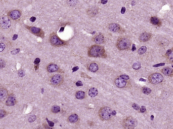 RNF128 Rabbit Polyclonal Antibody