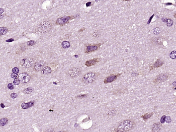 RNF128 Rabbit Polyclonal Antibody