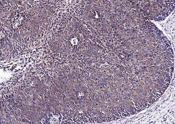 S100A10 Rabbit Polyclonal Antibody