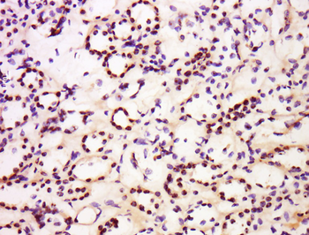 Nucleophosmin Rabbit Polyclonal Antibody