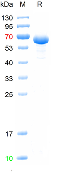 Recombinant human CK17 protein, N-Trx-His