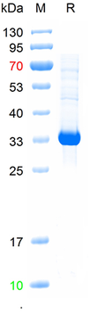 Recombinant human UCP1 protein, His