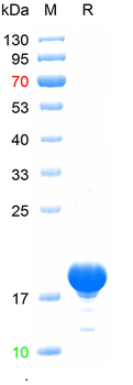 Recombinant mouse IL18 protein, N-His