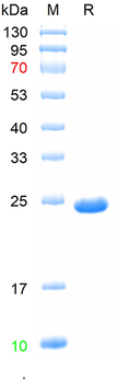 Recombinant human DR4 protein, C-His