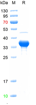 Recombinant human TASL protein, N-His