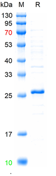 Recombinant human FOXP3 protein, N-His