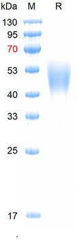 Recombinant mouse IL2RA protein, C-His (HEK293)