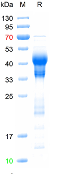 Recombinant mouse IL17RB protein, C-His