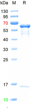 Recombinant Measles virus hemagglutinin protein, N-His