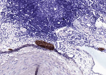 NCAM/CD56 Recombinant Mouse Monoclonal Antibody