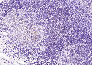CD74 Recombinant Rabbit Monoclonal Antibody