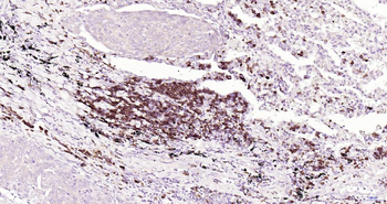 CD79A Recombinant Rabbit Monoclonal Antibody