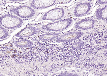 Human IgA Mouse Monoclonal Antibody