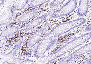 CD38 Mouse Monoclonal Antibody