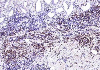 CD38 Mouse Monoclonal Antibody