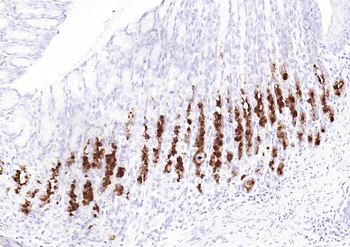 MUC6 Mouse Monoclonal Antibody